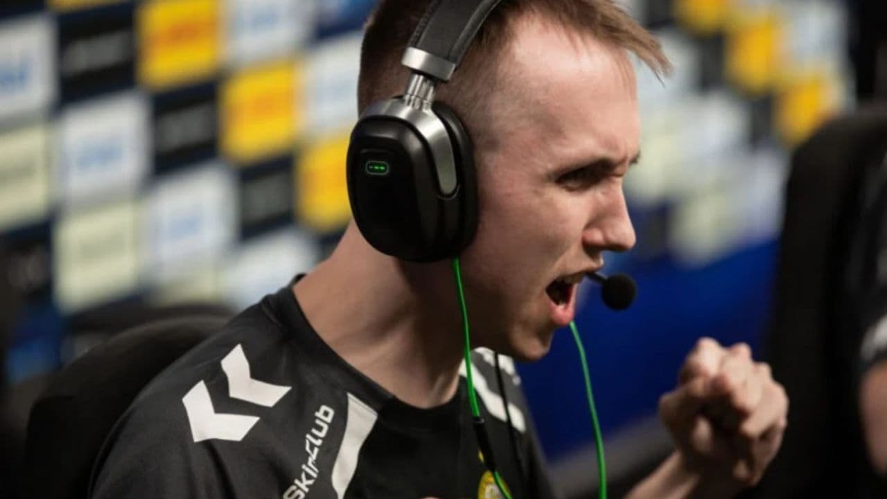 ropz cs2 settings